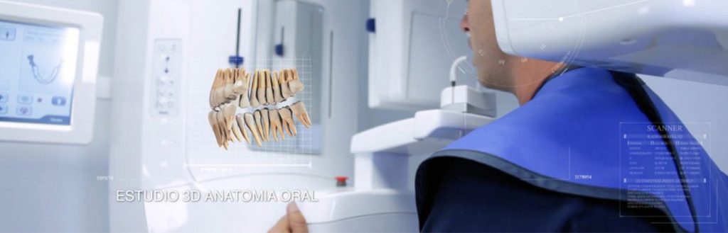 planificacion-implantes-1024x329